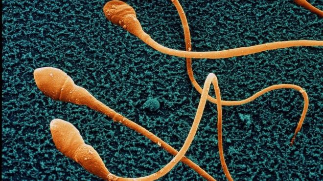 Penelitian Tentang Berkurangnya Produksi Sperma Membuktikan Manusia Berada di Ambang Kepunahan