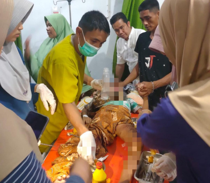 Pulang Tarawih, Anak di Rokan Hilir Diserang Buaya, Ibu Selamatkan dengan Cepat