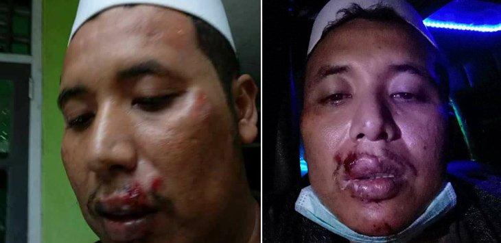 Usai Ceramah PKI, Ketua FPI Babak Belur Dipukuli Dua Pria