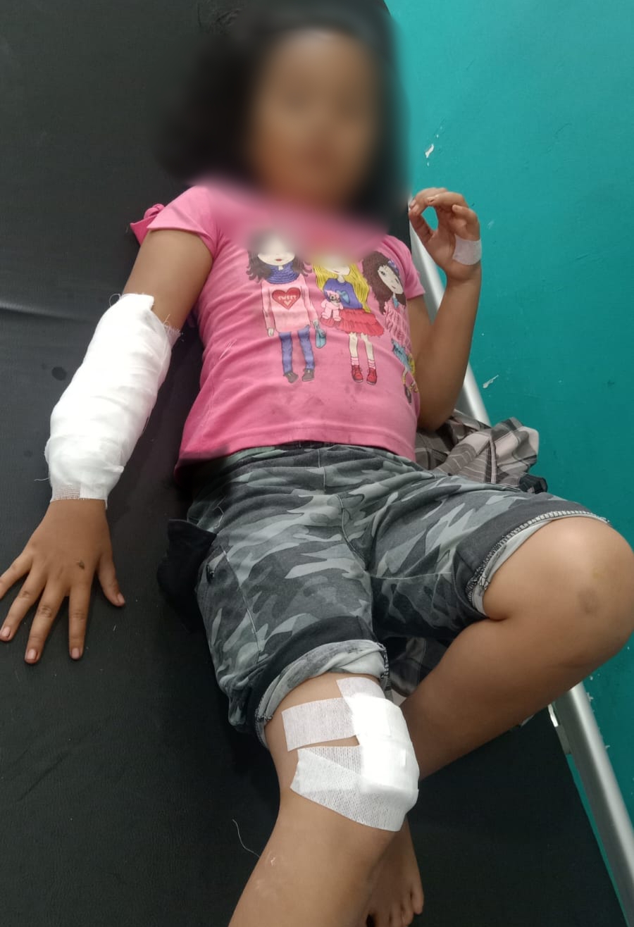 Tangan dan Kaki Bocah 9 Tahun ini Dijahit Usai Digigit Siamang Peliharaan Warga 