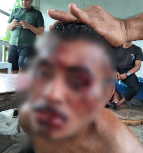 Acungkan Parang ke Warga Saat Kepergok Mencuri di Sekolah, Maling di Pekanbaru Babak Belur