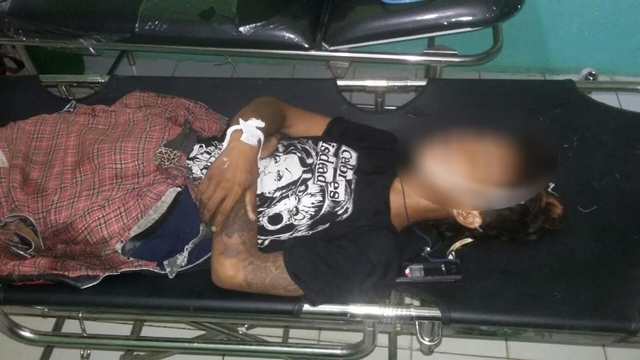 Ternyata, Anak Punk yang Tergilas Tronton Warga Lampung
